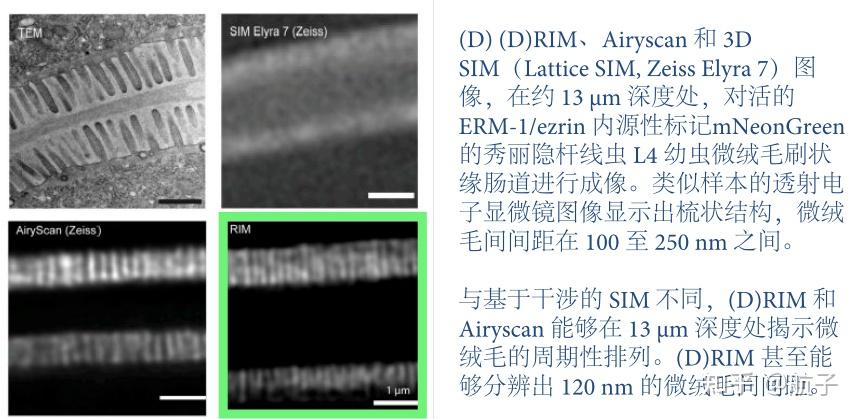 RIM 与 SIM、Airyscan 在厚样本中的成像对比